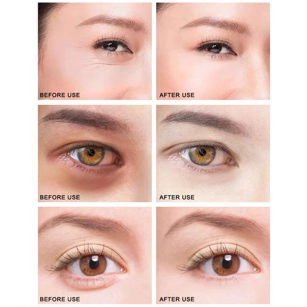 ARTISCARE Black Pearl Eye Patches 60pcs for Moisturizing and Dark Circles Collagen Under Eye Mask Skin Care Products